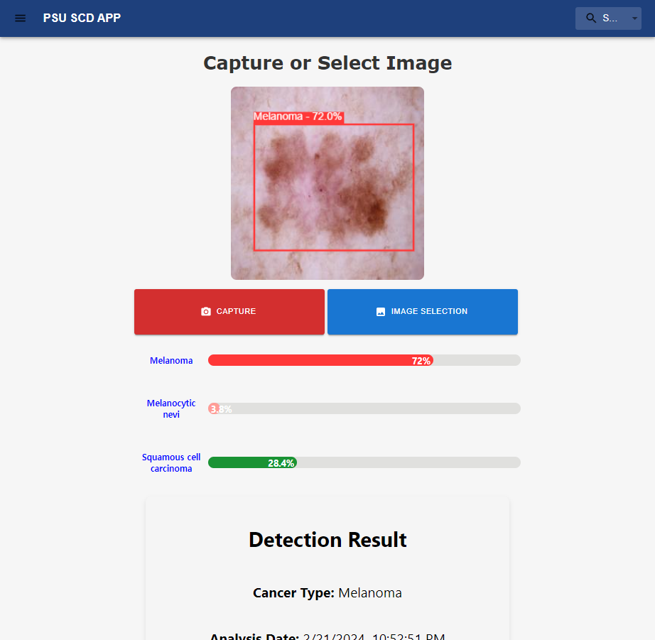 Skin Cancer Detection Project
